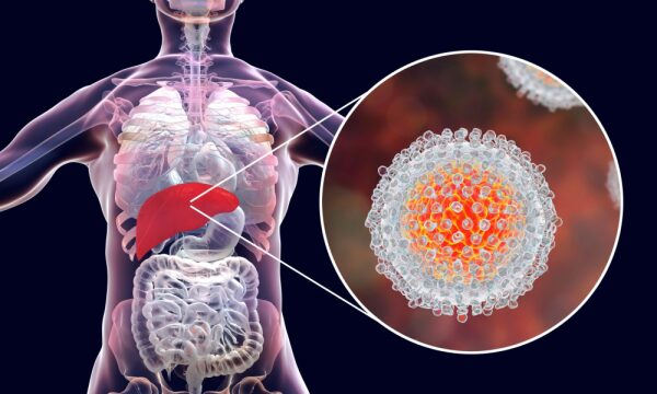 činjenice o hepatitisu c | prevencija i lecenje, zdravlje, magazin